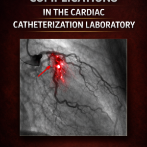 Hidden and Open Cath Lab Complications